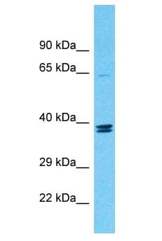 Polyclonal Rabbit anti-Human TMEM236 Antibody (aa150-199, WB)