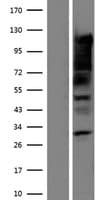 SRF / Serum Response Factor Protein (Over-Expression Lysate Myc-DDK (Flag))