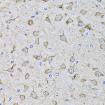 DFFA / ICAD / DFF45 Antibody