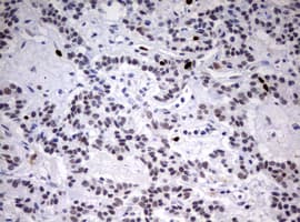 TOP2A / Topoisomerase II Alpha Antibody (aa1100-1531, clone OTI2A9)