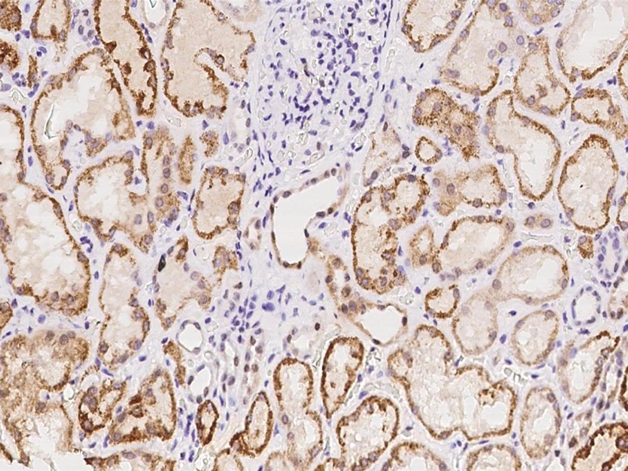 GLYATL1 Antibody
