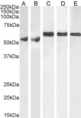 IHC-plus™ Polyclonal Goat anti-Human QIP1 / KPNA4 Antibody (aa509-521, IHC, WB)