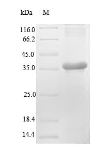 Mouse Ren2 / Renin-2 Protein (Recombinant 6His, N-terminus)
