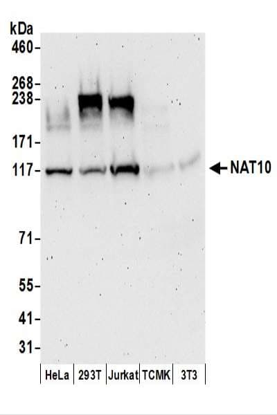 NAT10 Antibody (aa650-700)