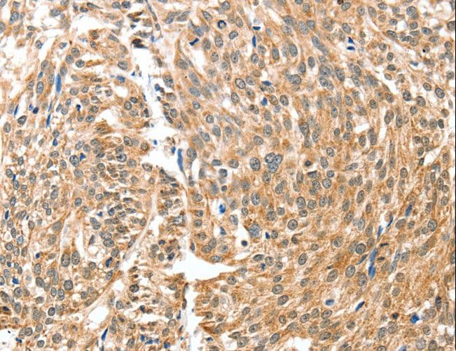BAX Antibody