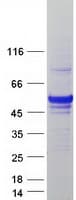 Human UXS1 Protein (Recombinant Myc-DDK (Flag))