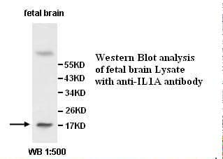 Polyclonal Rabbit anti-Human IL1A / IL-1 Alpha Antibody (IHC, WB)