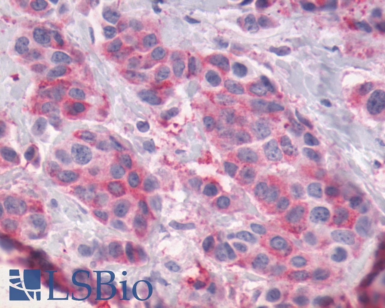 IHC-plus™ Polyclonal Rabbit anti-Human ADGRG1 / GPR56 Antibody (Cytoplasmic Domain, IHC)