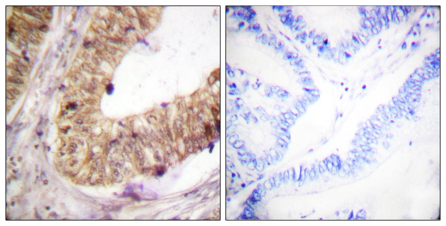 ATRIP Antibody (p68/72)