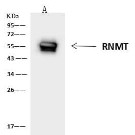 Polyclonal Rabbit anti-Human RNMT / HCM Antibody (IF, WB)