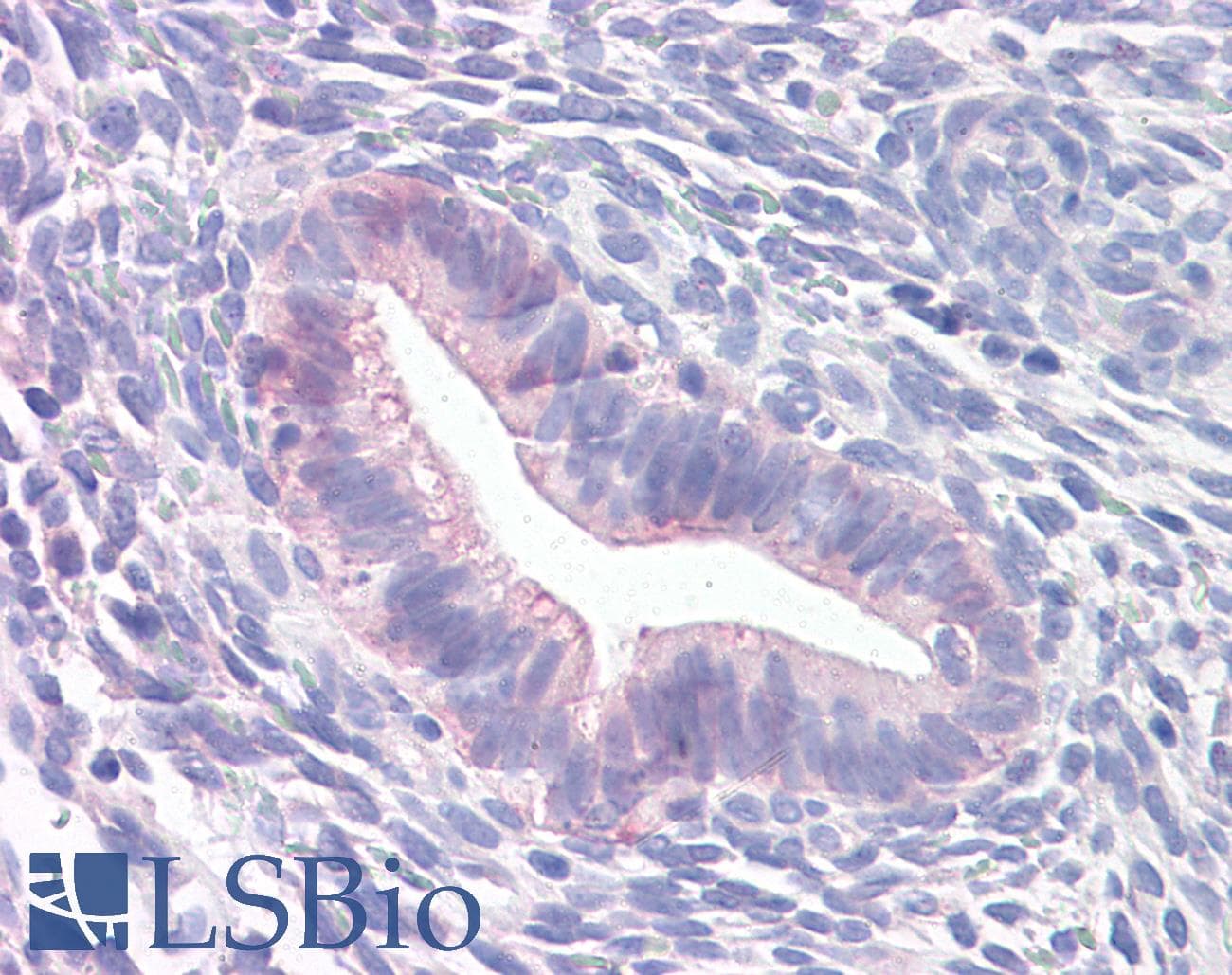 IHC-plus™ Prominin 2 / PROM2 Antibody (Internal)