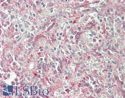 IHC-plus™ Polyclonal Rabbit anti-Human KCNMB2 Antibody (Internal, IHC, WB)