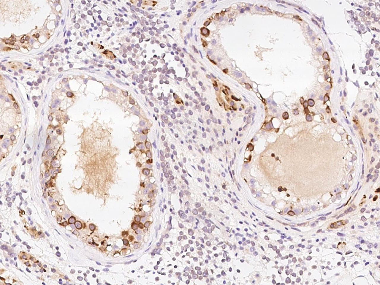PPP2R1B Antibody