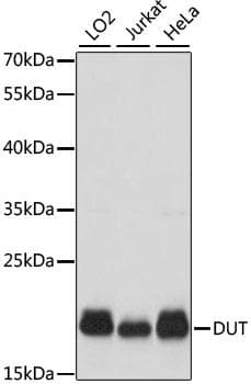 Polyclonal Rabbit anti-Human DUT / DUTPase Antibody (IHC, IF, WB)