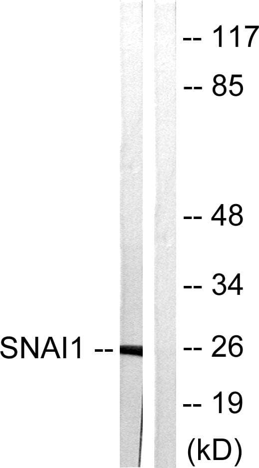 SNAI1 / SNAIL-1 Antibody (p246)