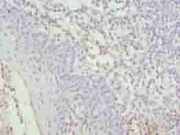 Polyclonal Rabbit anti-Human C17orf62 Antibody (IHC, WB)
