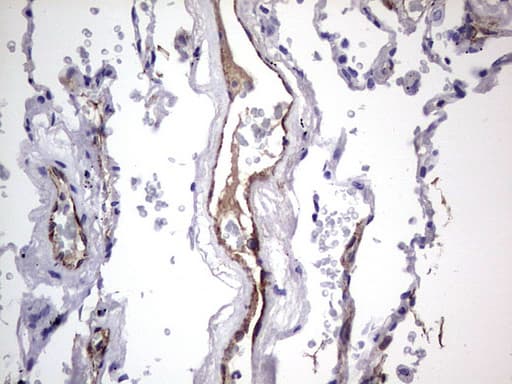VWF / Von Willebrand Factor Antibody (aa764-1263, clone OTI7G3, Carrier-free)
