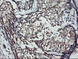 Monoclonal Mouse anti-Human ERBB2 / HER2 Antibody (clone OTI1C5, Carrier-free, aa676-1255, IHC, IF, WB)