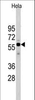 IHC-plus™ Polyclonal Rabbit anti-Human CDC25A Antibody (aa271-300, IHC, WB)