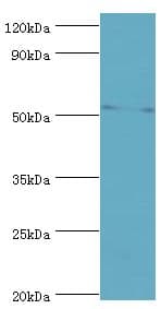 IHC-plus™ GCK / Glucokinase Antibody (aa1-300)