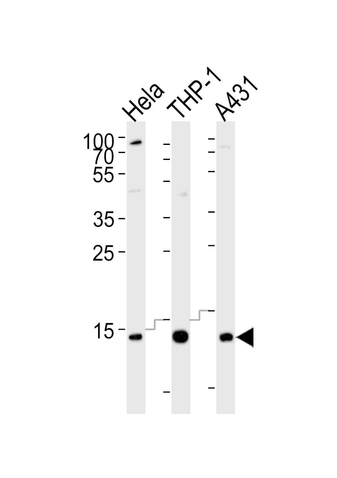 Monoclonal Mouse anti-Human VAMP8 / VAMP-8 Antibody (clone 1414CT354.12.23.93, aa2-24, WB)