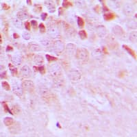 TRAF3IP1 Antibody (Internal)