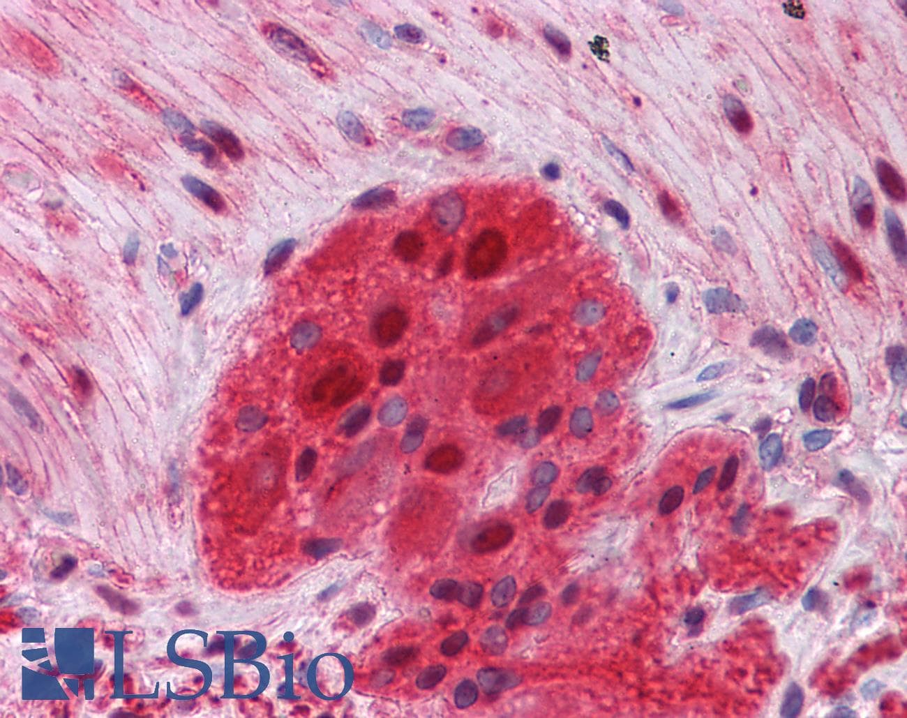 IHC-plus™ RCHY1 / PIRH2 Antibody (clone 1H10)