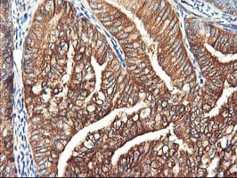 PFKP Antibody (clone OTI2E8, Carrier-free)