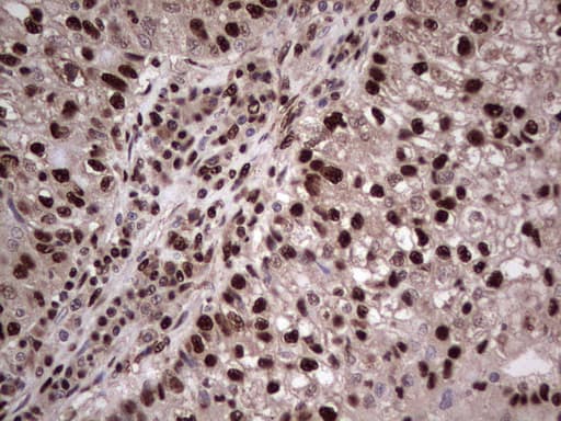 Monoclonal Mouse anti-Human SAE1 Antibody (clone OTI6B11, IHC, WB)