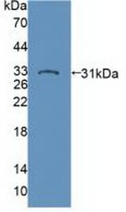 PTPN22 / PEP Antibody