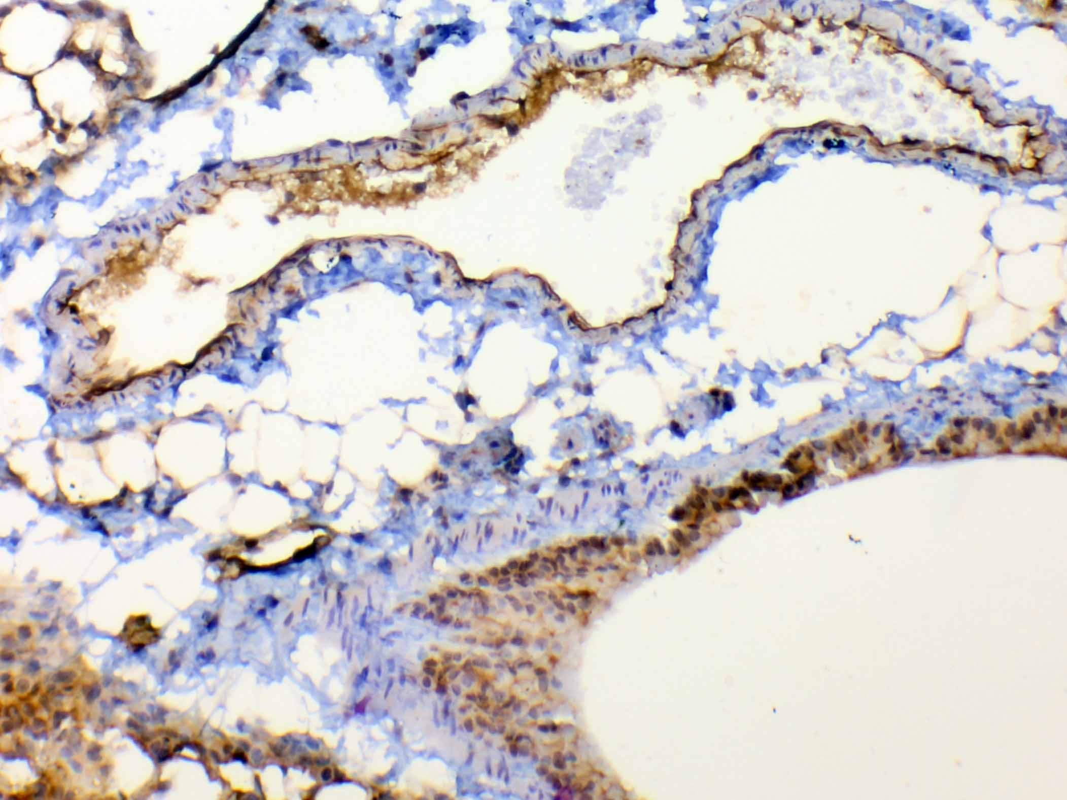 Polyclonal Rabbit anti-Human TSPAN12 Antibody (IHC, WB)