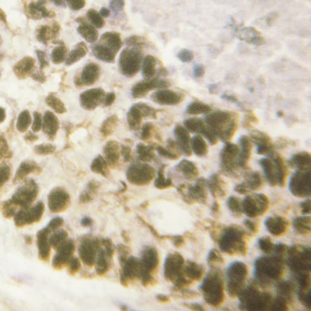 AML1 / RUNX1 Antibody (phospho-Ser303)