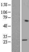 RPL15 / Ribosomal Protein L15 (Over-Expression Lysate Myc-DDK (Flag))