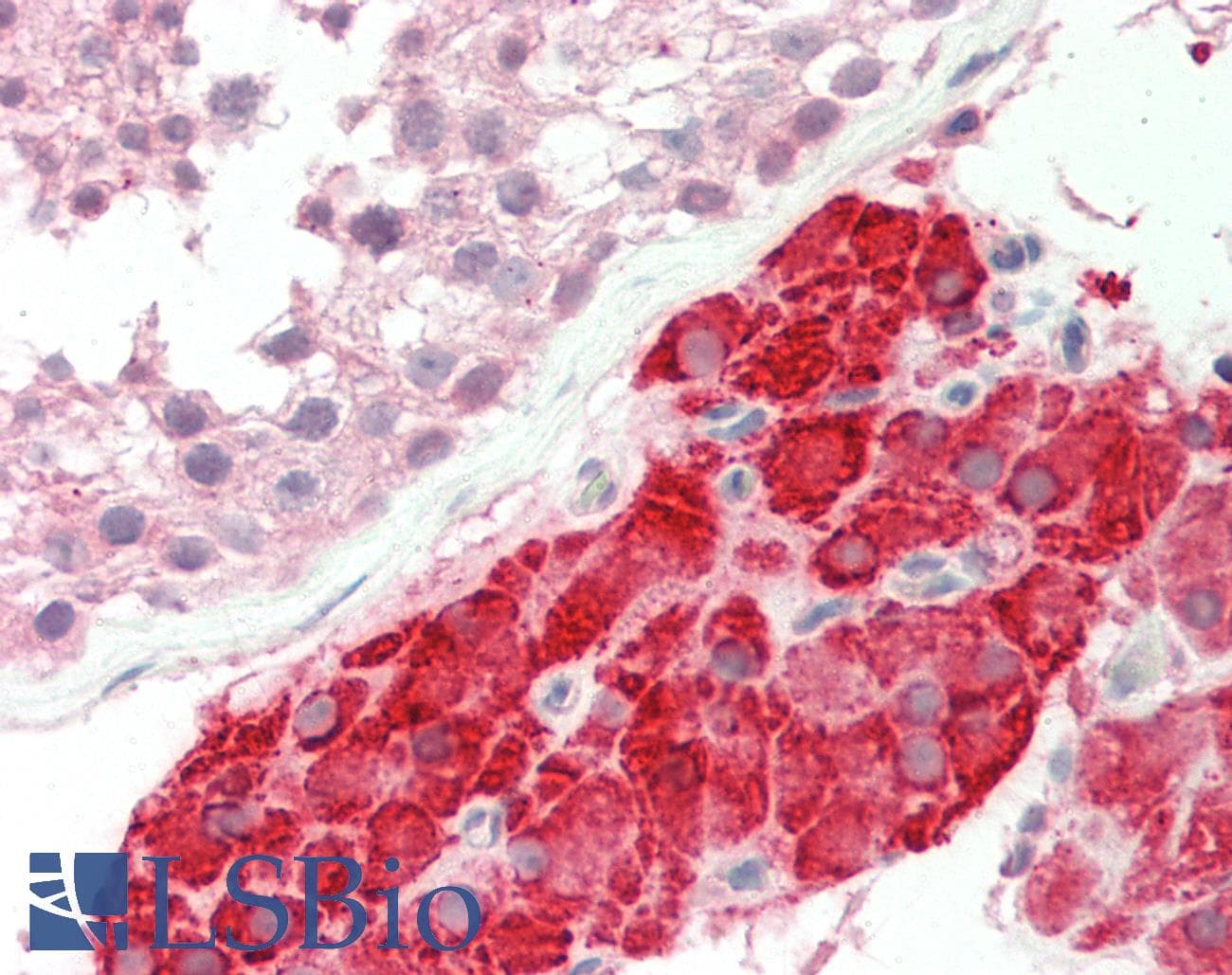 NR2E1 / TLX Antibody (aa144-193)