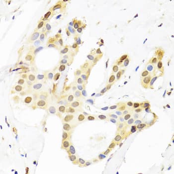 SUZ12 Antibody