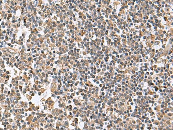 KRCC1 Antibody