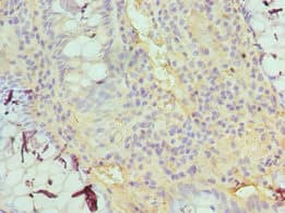TDG / Thymine DNA Glycosylase Antibody (aa141-410)