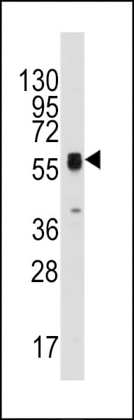TP / Thymidine Phosphorylase Antibody (aa318-345)