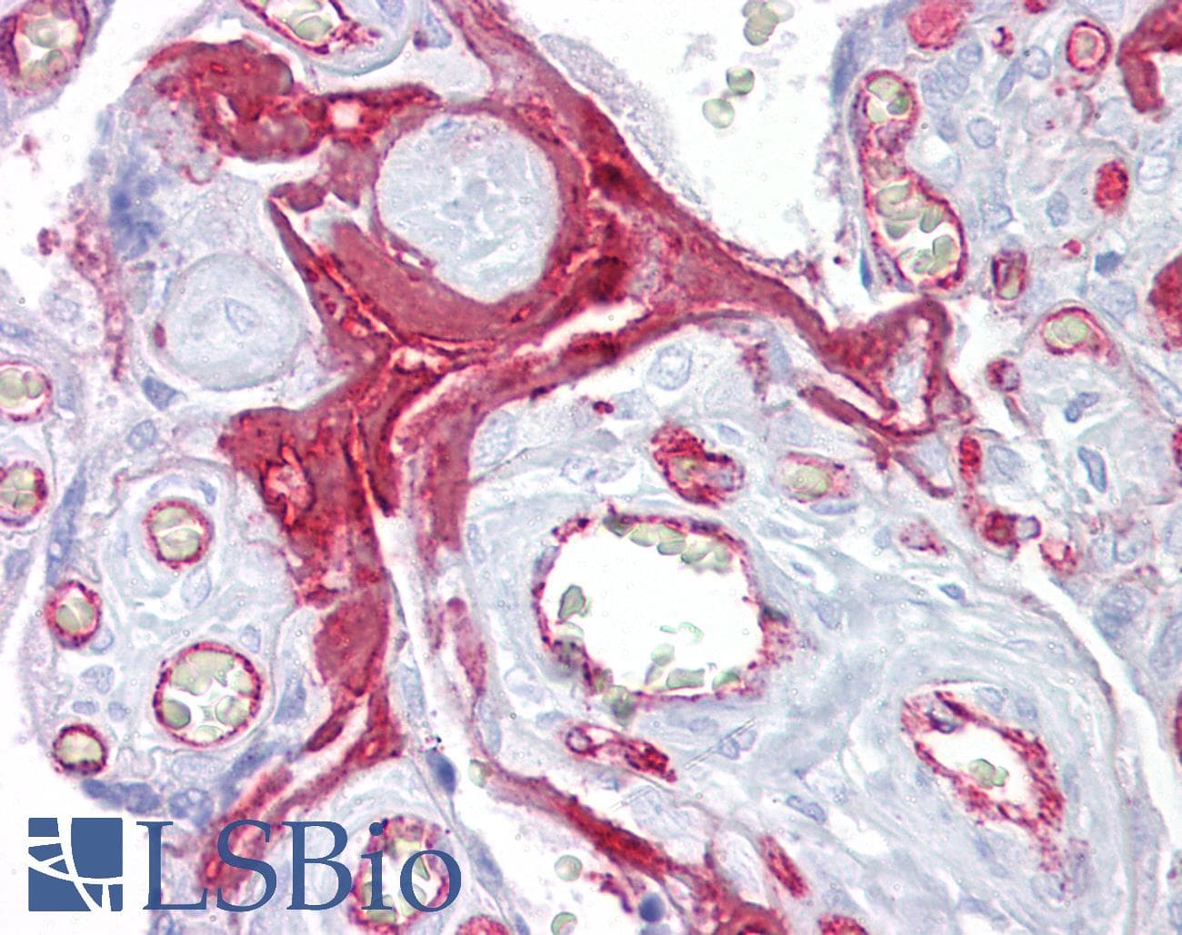 FGG / Fibrinogen Gamma Antibody (aa216-265)