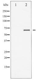 Polyclonal Rabbit anti-Human SYK Antibody (IHC, WB)