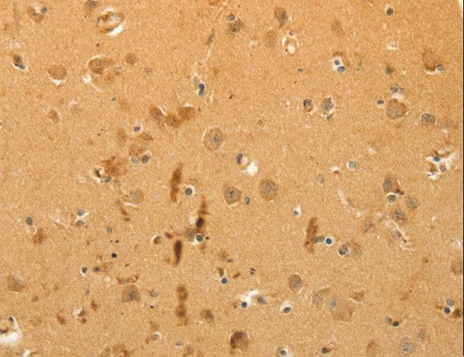 CFHR1 Antibody