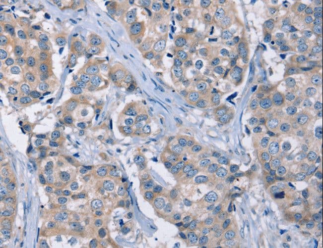 KCNQ5 Antibody