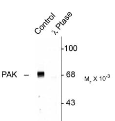 Polyclonal Rabbit anti-Rat PAK1 + PAK2 + PAK3 Antibody (phospho-Thr423, WB)