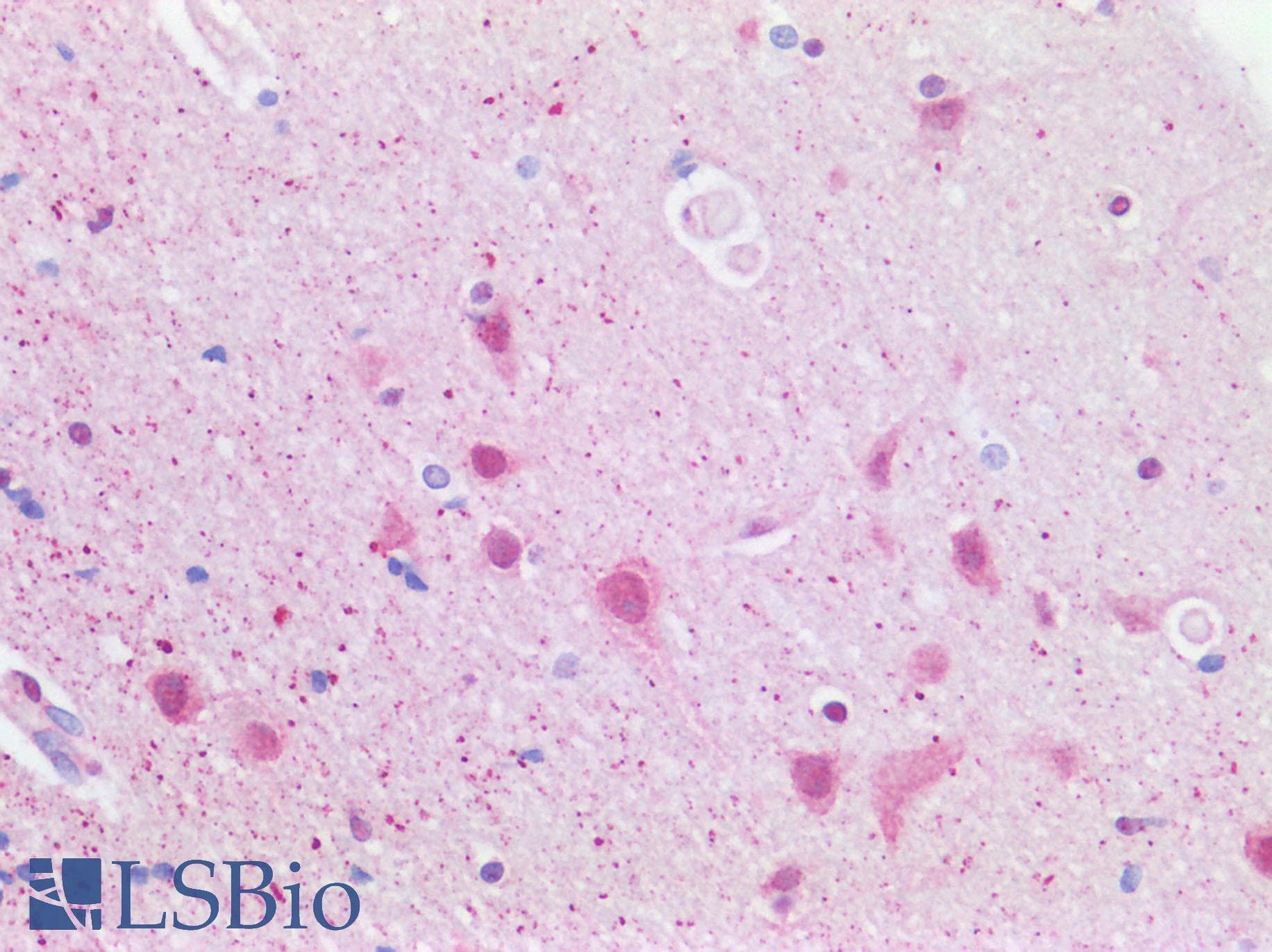 FAN1 Antibody (aa1-50)