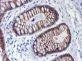 ERBB2 / HER2 Antibody (aa676-1255, clone OTI11A7, Carrier-free)