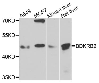 BDKRB2/Bradykinin B2 Receptor Antibody