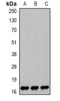 Polyclonal Rabbit anti-Human NPC2 Antibody (IF, WB)