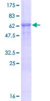 Human CARNS1 Protein (Recombinant GST)