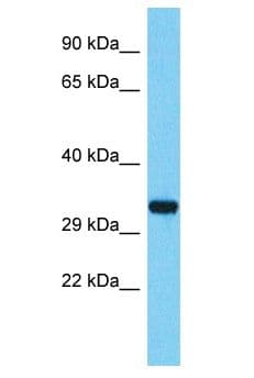 Polyclonal Rabbit anti-Human TMEM236 Antibody (FITC, aa167-216, WB)