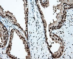 Monoclonal Mouse anti-Human TLDC1 / KIAA1609 Antibody (clone OTI5D9, IHC, IF, WB)